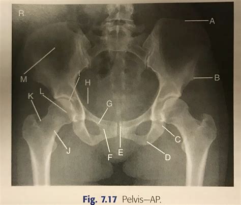 Ap Pelvis Diagram Quizlet