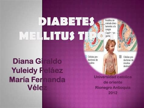 Diabetes Tipo 1 Ppt Descarga Gratuita