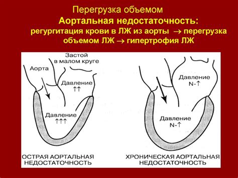 Недостаточность кровообращения - презентация онлайн