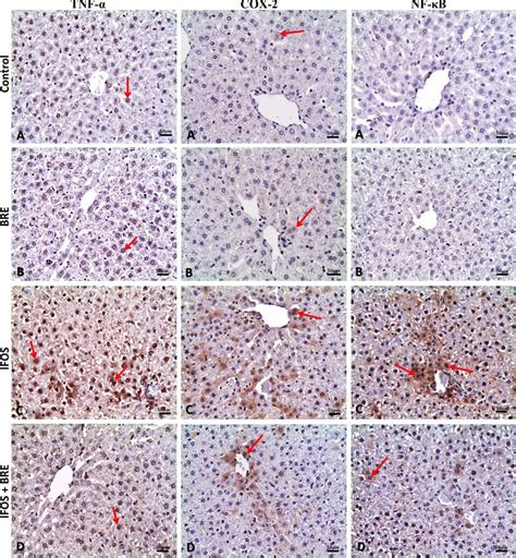 Representative Histopathological Photomicrographs Of Rat Liver Sections