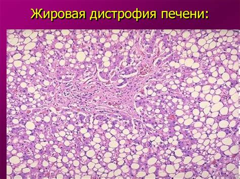 Повреждения. Паренхиматозные дистрофии - презентация онлайн