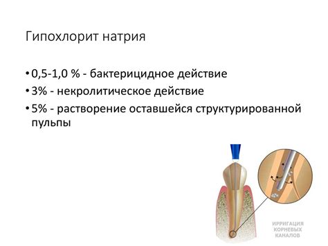 Стандартизированная методика обработки корневых каналов. Этапы ...