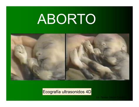 Aborto Pp Ppt Descarga Gratuita