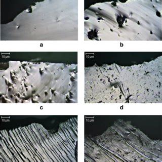 Photographs (100×) demonstrating variation in ventral surface ...