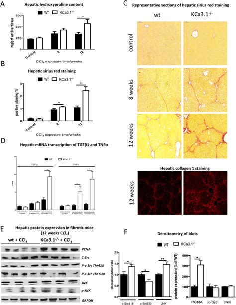 Effect Of Genetic Kca31 Depletion In Ccl 4 Induced Liver Fibrosis In