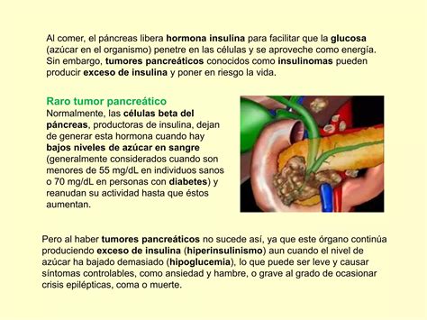 Insulinomas Raro Tumor Pancre Tico Ppt