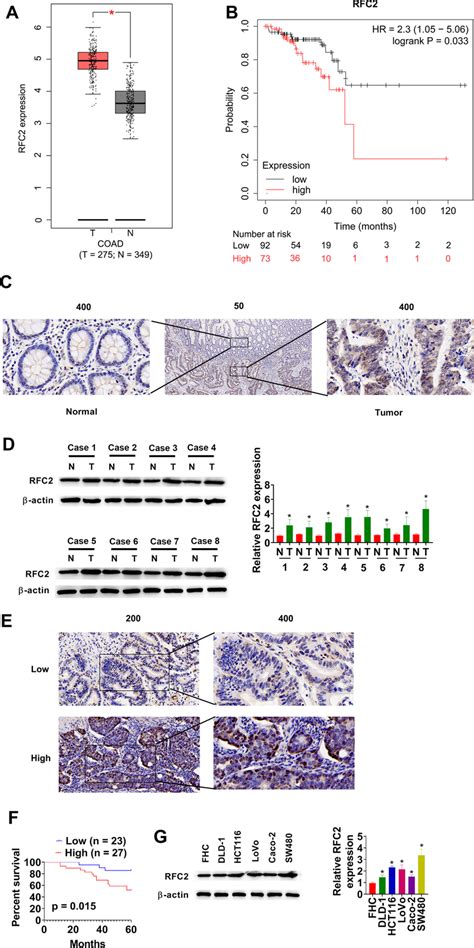 Rfc Is Upregulated In Crc Tissues A Expression Of Rfc In Tcga Coad