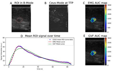 Diagnostics Free Full Text Quantification And Classification Of