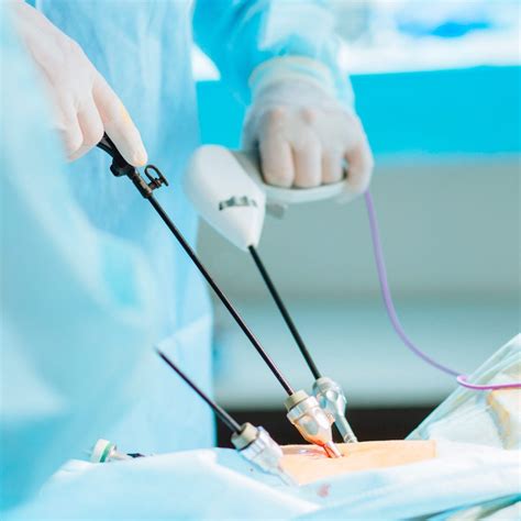 Quanto Tempo Demora Uma Cirurgia De Videolaparoscopia