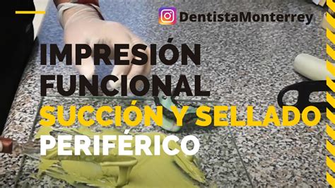 Sellado Perif Rico Impresi N Funcional Pr Tesis Dental Inferior