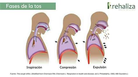 Tres Formas Efectivas De Combatir La Tos Productiva Neurat