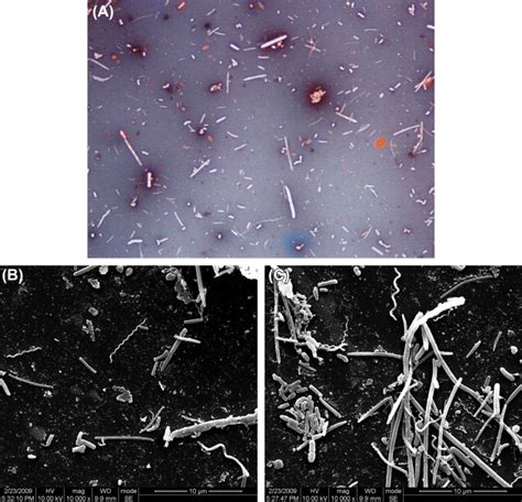 Treponema - MRGI - Microbiota Research Group of Iran