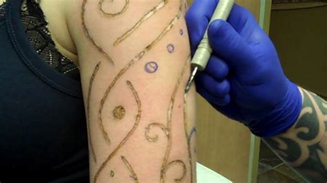 Arm Branding At Evolution Body Piercing Part 2 Youtube