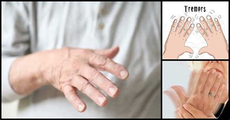 Common Causes Of Hand Tremors (Shaky Hands) | Dr Farrah MD