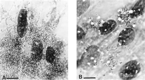 Intracellular Replication Assay E Derm Cells Were Infected By The T