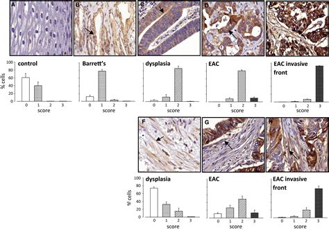 Matrix Metalloproteinase Mmp In Barrett S Esophagus And Esophageal