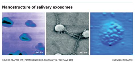 Saliva The Next Frontier In Cancer Detection The Wire Science
