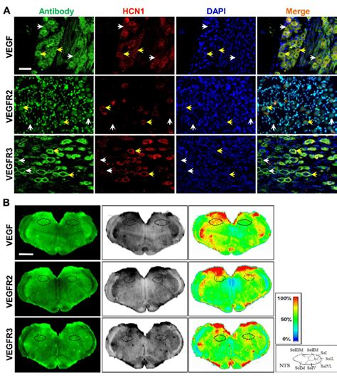 Immunohistochemical Characterization Of The Expression And Distribution