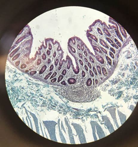 Large Intestine Histology 7 Diagram Quizlet