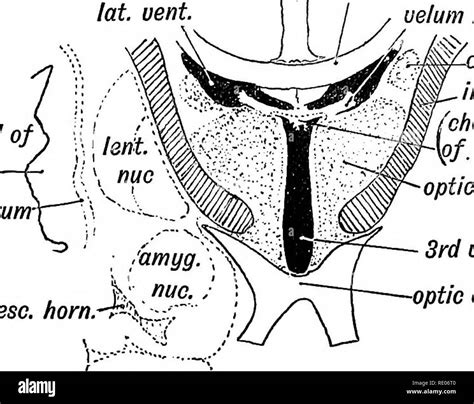Lamina Terminalis Hi Res Stock Photography And Images Alamy