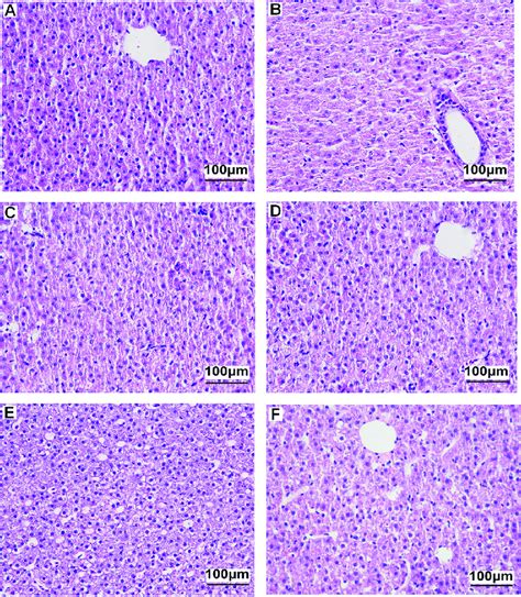 Histopathological Observation Of Liver Tissue In Zebrafish