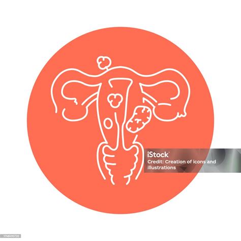 Uterine Myoma Color Line Icon Gynecology Problem Stock Illustration