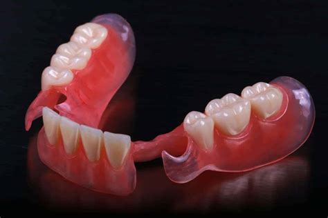 Flexible Partial Dentures