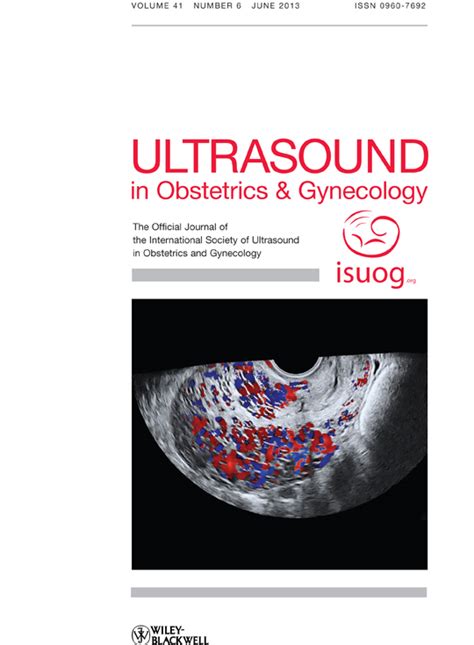 Uterine Sliding Sign A Simple Sonographic Predictor For Presence Of Deep Infiltrating