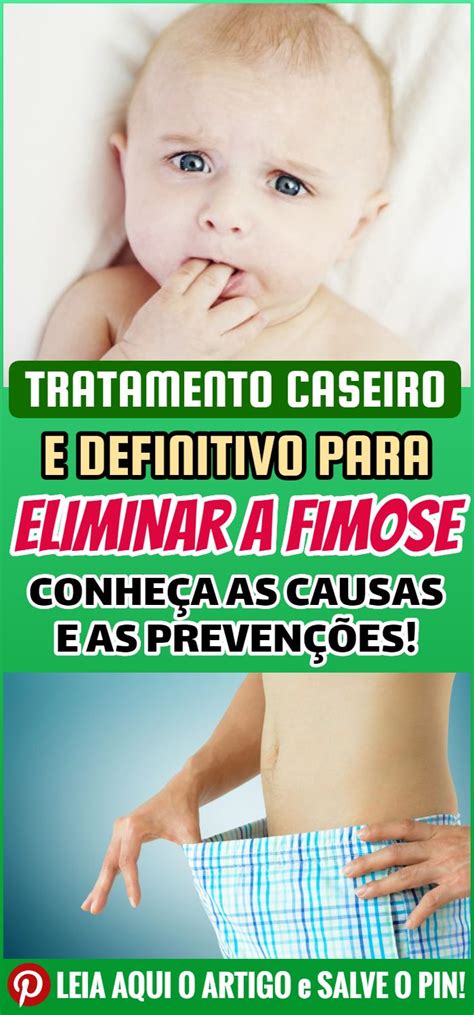 Fimose Conheça As Complicação Que Atinge Muitos Homens Conhecendo