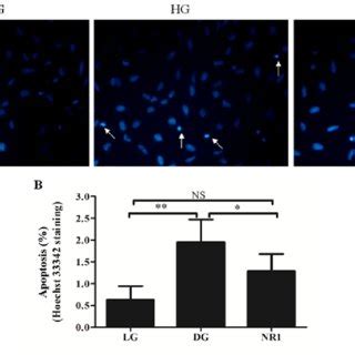 Notoginsenoside R1 NR1 Induces Autophagy A Western Blot Analysis