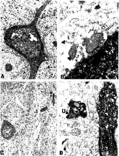 Electron Micrographs Of Synaptic Contacts Bel Vet N Intrinsic Motor