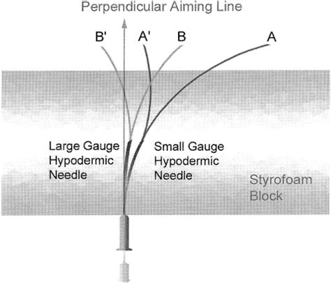 The Effect Of Introducer Gauge Design And Bevel Direction On The