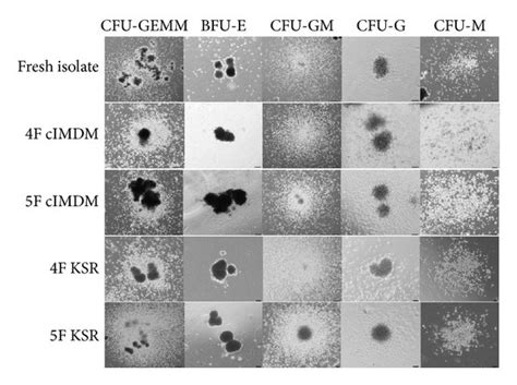 Hematopoietic Colony Forming Units And Differentiation Capacity Of