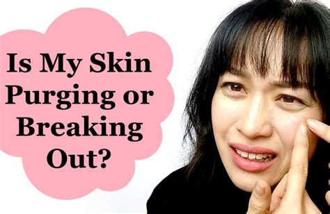 Purging Vs Breakouts When To Ditch Your Skincare Rejuvenating Sets