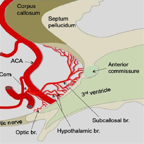 Meila D Et Al 9 Schematic Drawing Of The Anterior Communicating Download High Resolution