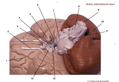 The Brain Inferolateral View Flashcards Quizlet