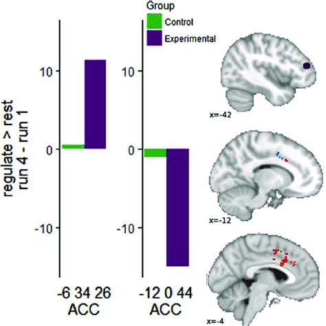 Pdf Using Connectivity Based Real Time Fmri Neurofeedback To Modulate