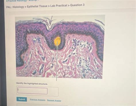 Solved PAL Histology Epithelial Tissue Lab Practical Chegg