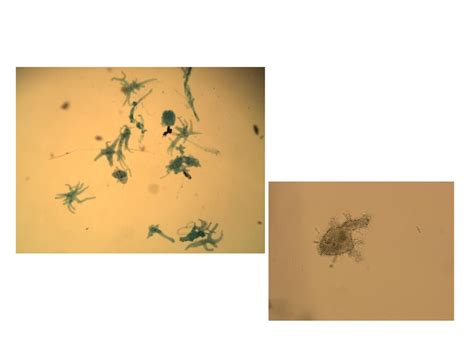 Diplomonads - Giardia. - ppt download