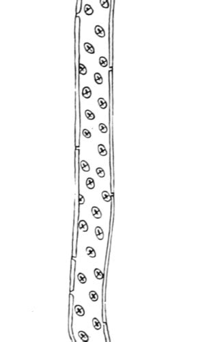 Difference Between Tracheids and Vessels | Definition, Characteristics ...