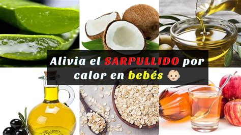 Remedios Caseros Para Aliviar El Sarpullido Por Calor Youtube