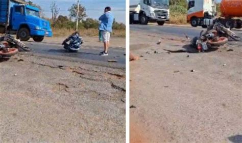 Motos Batem De Frente E Deixam Pilotos Feridos Em VG FOLHAMAX