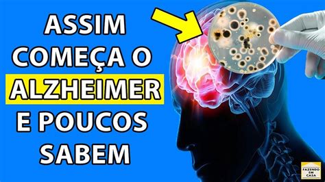 Se Você Tem 1 Destes Sintomas Pode Ser Início do ALZHEIMER e NÃO SABE