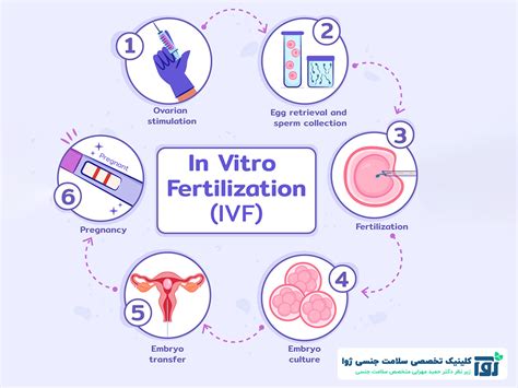 لقاح آزمایشگاهی یا Ivf چیست و مراحل آی وی اف دکتر حمید مهرابی