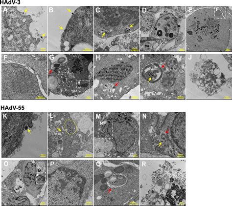 Journal Of Virology│我院张其威教授团队建立腺病毒呼吸道类器官感染模型，揭示人55型腺病毒引起高致病性的机制