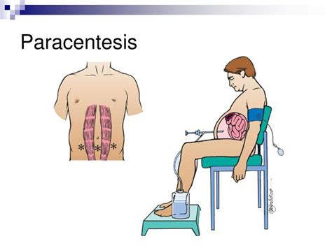 Assessment And Management Of Patients With Hepatic And Biliary