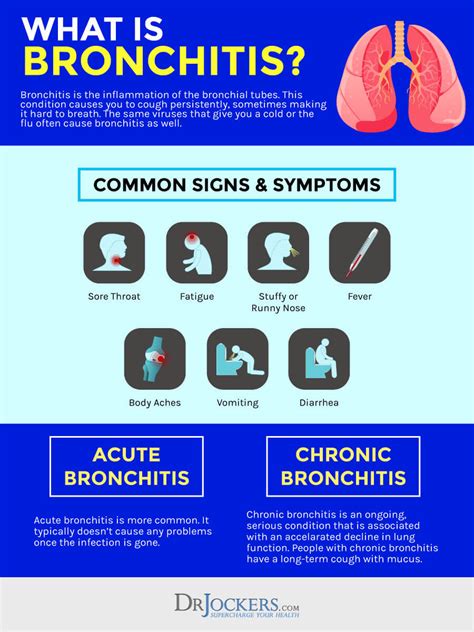 How To Cure Acute Bronchitis Internaljapan9