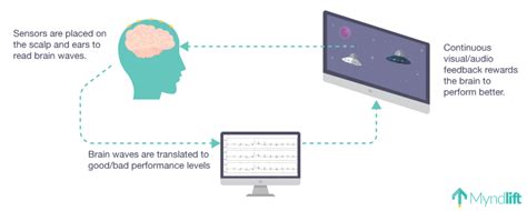 Neurofeedback Sex Addiction And Marriage Counseling Bull City