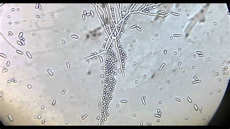 Mohos Y Levaduras Al Microscopio YouTube