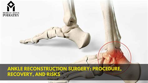 Ankle Reconstruction Surgery: Procedure, Recovery, And Risks